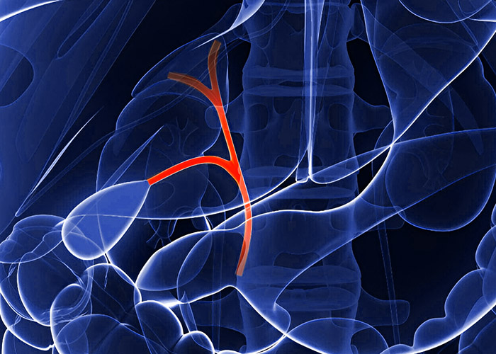 Cáncer de Vías Biliares